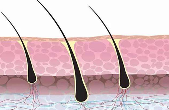 脫髮很久的毛囊,如何救,如何再次生髮