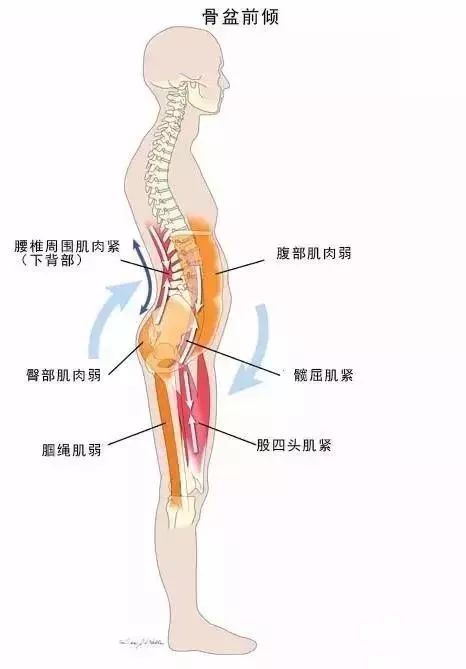 冬天腰痠疼?我們把原因和解決方法都給您準備好了