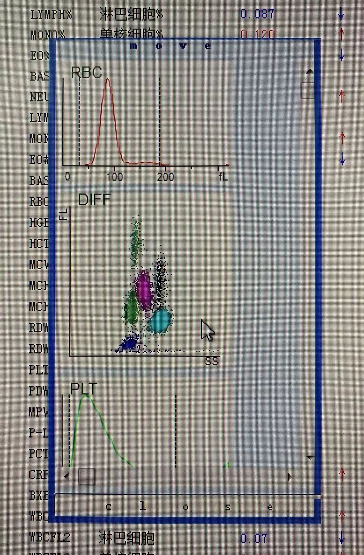 白細胞散點圖有多重要,看了就知道