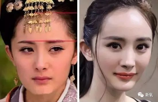 不用掀开头皮垫额骨也能get林青霞同款完美头骨