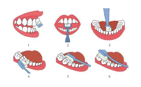 慣用手為右手的人從上排右邊最後一顆牙開始,依次刷牙齒右後方頰側,左