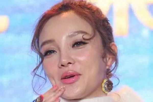 被玻尿酸摧残女星:李小璐和关之琳面部僵硬,网友:根本没眼看