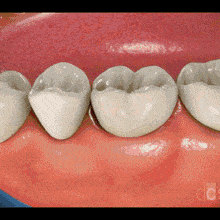 就等于牙龈萎缩,牙齿松动,牙齿脱落毕竟很多人印象中的"牙周病"你不是