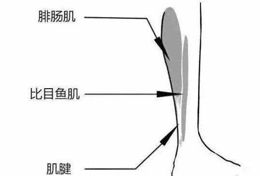 第二是骨关节结构排列错位,如距骨前移,导致卡住踝关节完成背屈动作