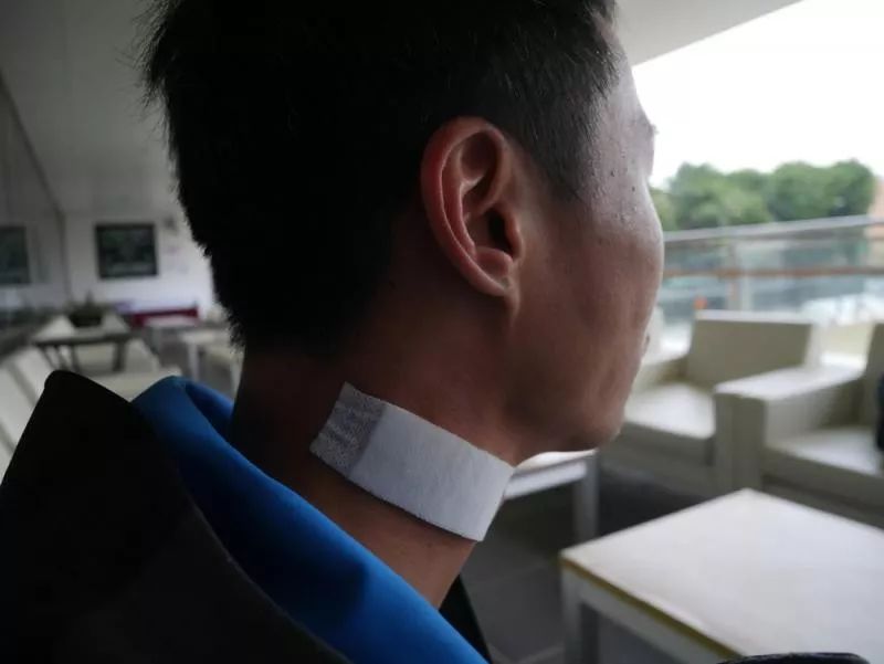 香港警察alex(化名)是重伤者之一,alex颈部的伤痕目前仍用纱布包扎着