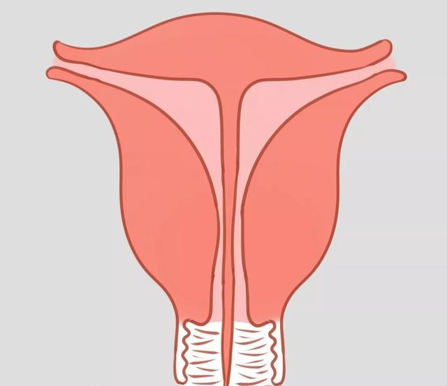 子宮畸形的三種情況:縱膈子宮,雙角子宮和雙子宮__鳳凰網