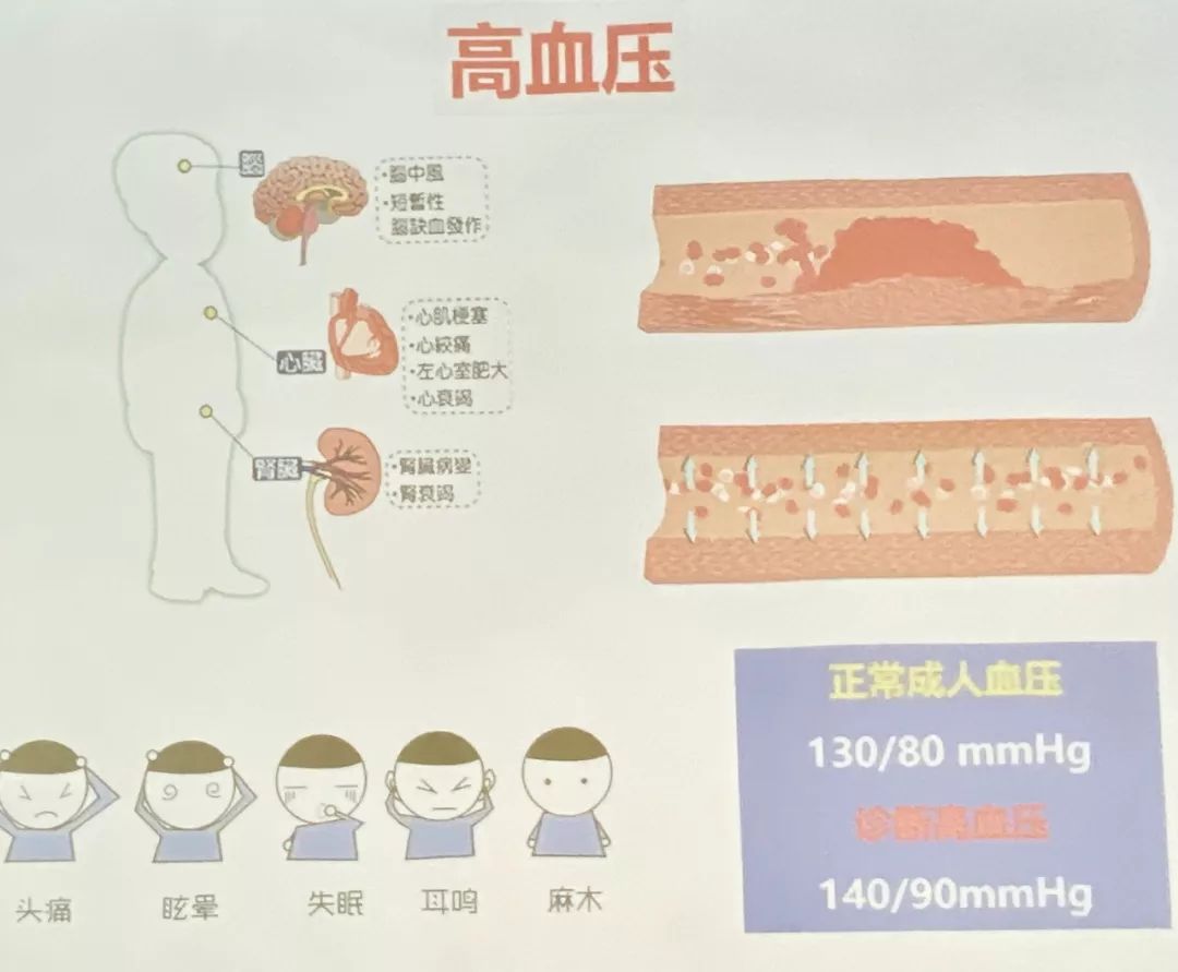 “00010203 ”心脏骤停时,还能做这些__凤凰网