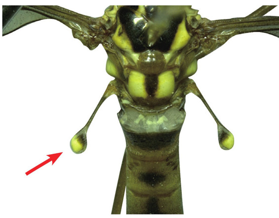 昆虫胸足的类型图片