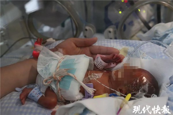 出生时命悬一线的700克"掌中宝",如今长成了胖娃娃