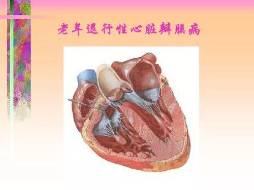 老年性退行性心脏瓣膜病不想手术,能保守治疗吗__凤凰网
