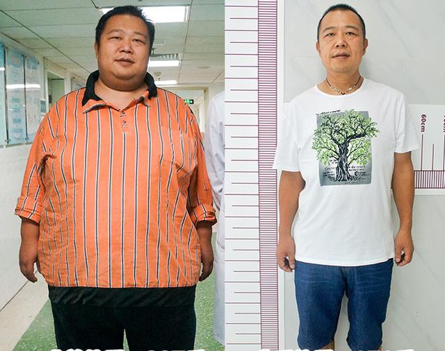 减重手术经典案例这位广西第一胖胖470斤面临生命威胁
