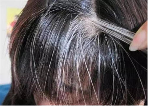 年纪轻轻满头白发?