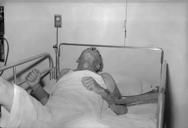 1959年拍摄的一位狂犬病病人的最后时光 那狂犬病病毒是怎样弄垮人的