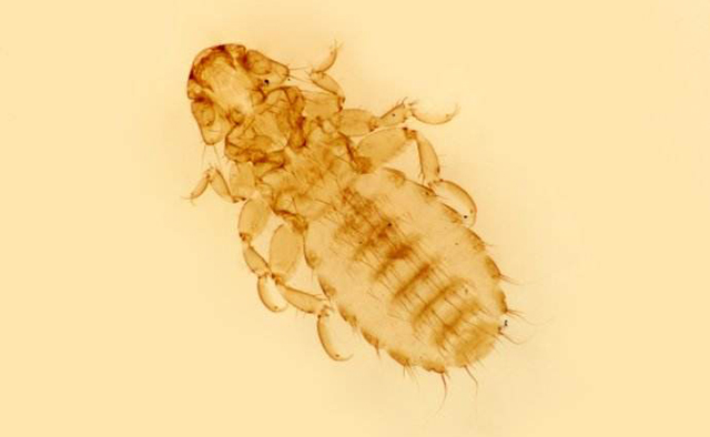 虱目(phthiraptera)吸虱亚目(anoplura)500多种小而无翅,扁平的蝨子