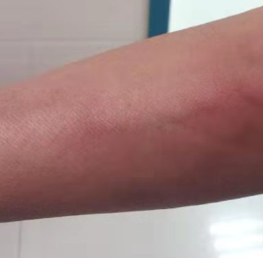 刺激性药物的滴速是快还是慢?