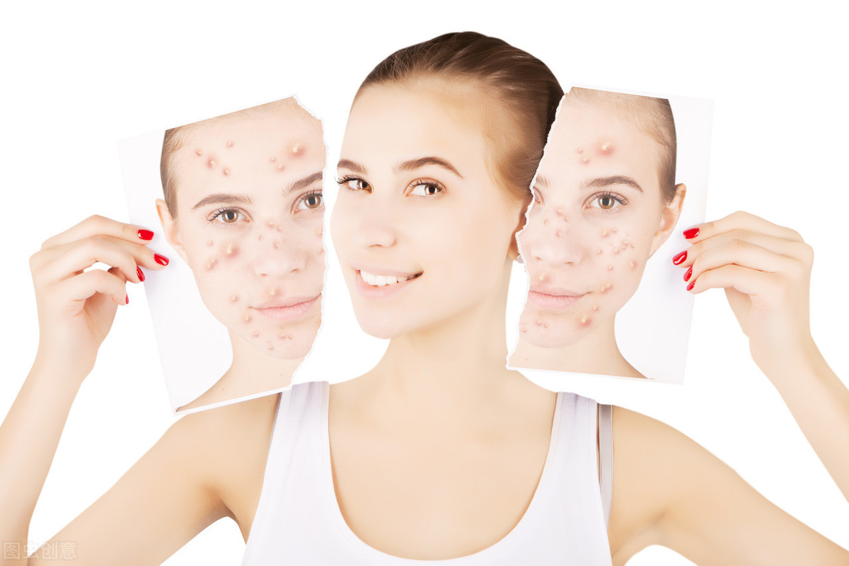 夏季肌肤多重困扰,英国科技护肤帮你解决__凤凰网