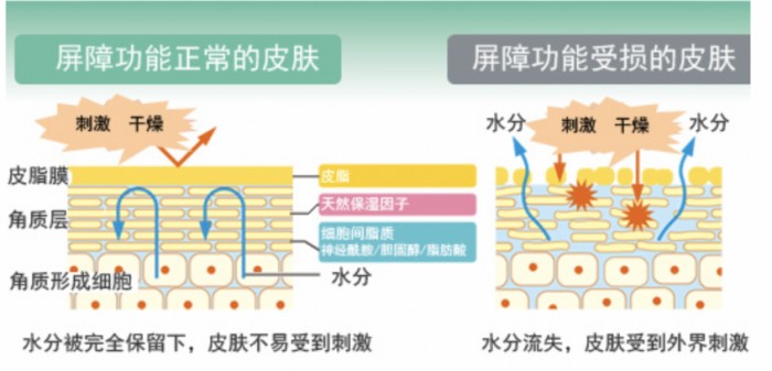 皮膚屏障通常是指皮膚的表層,主要由皮脂膜和角質層組成.