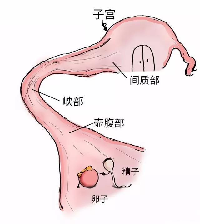 输卵管间质部图片