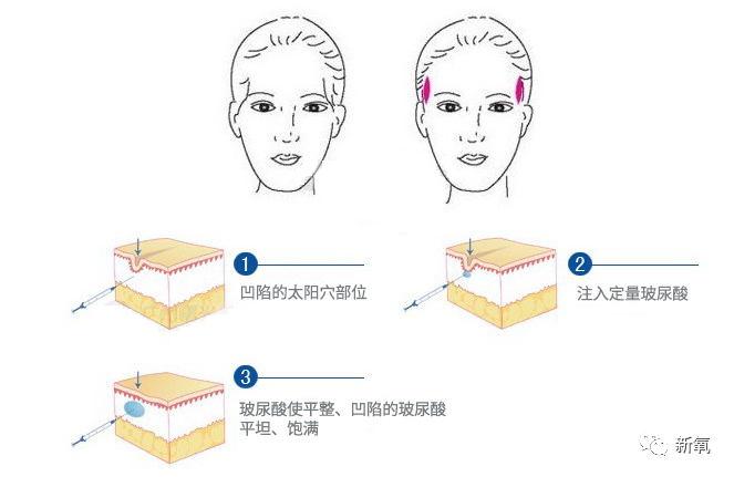 前妻现任对决,到底是意难平还是想开了?
