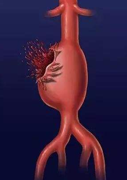 3大心脏"不定时炸弹"来了