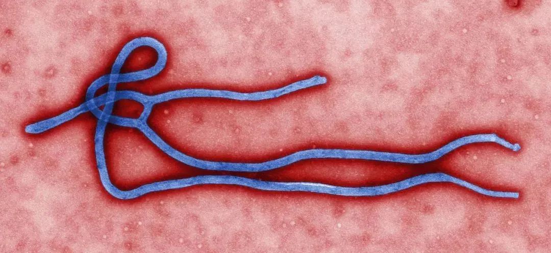 中国首例埃博拉病毒图片