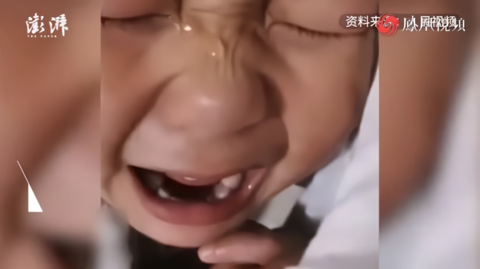 3岁娃看到妈妈剖腹产刀疤，心疼大哭“我不晓得你肚子疼”