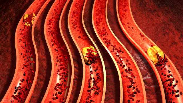 血液粘稠不粘稠看嘴就知道若没有3种表现说明血液保养不错