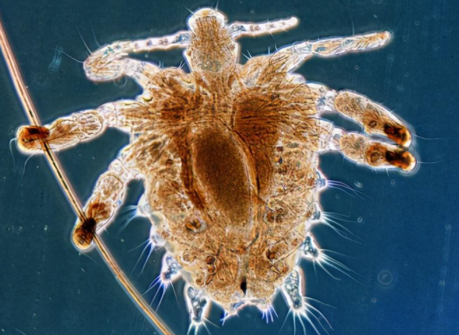 生活在我们身体上的虱子,一旦脱离了我们人体的体毛,在野外是活不过24