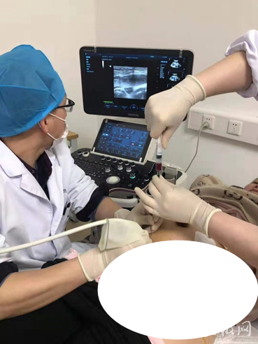 安徽首例双胎脐带血穿刺在中国科大附一院南区成功完成
