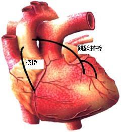 心脏搭脉怎么治疗_心脏位置(2)