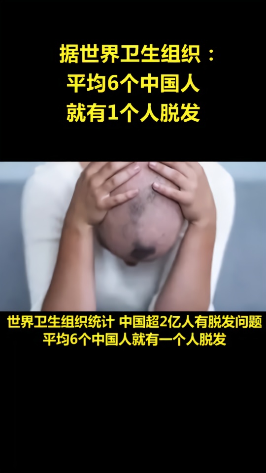 世界卫生组织：平均6个中国人就有1个人脱发