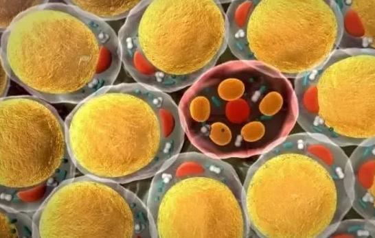 术后早期可能发生疼痛,水肿,瘀青,血肿,感染,脂肪聚集,脂肪液化,囊性