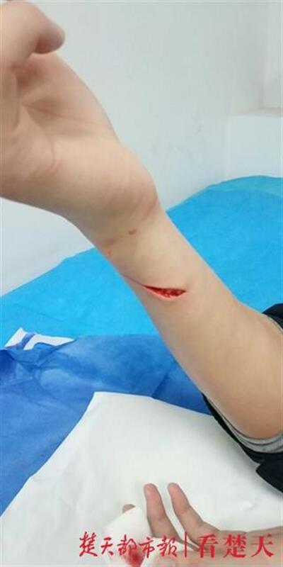 居民钻围挡外出发生意外民警挡住围挡被划伤缝了10多针