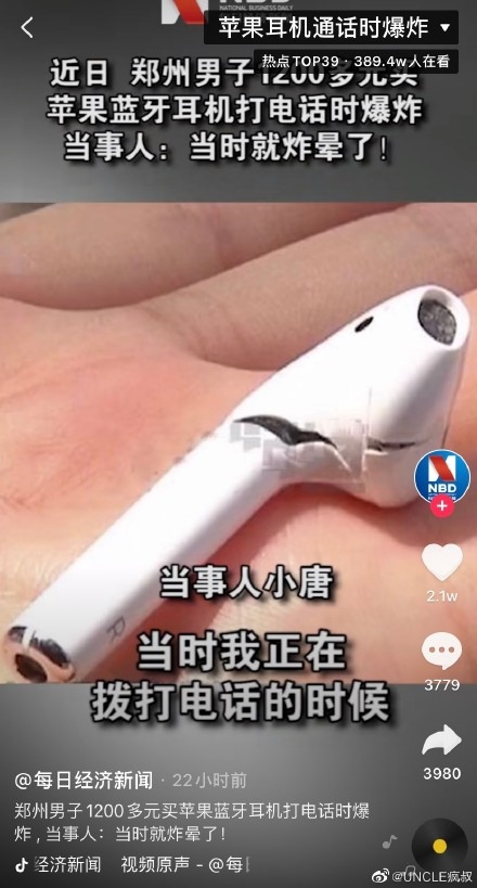 AirPods居然爆炸了?小伙被炸晕 右耳出血