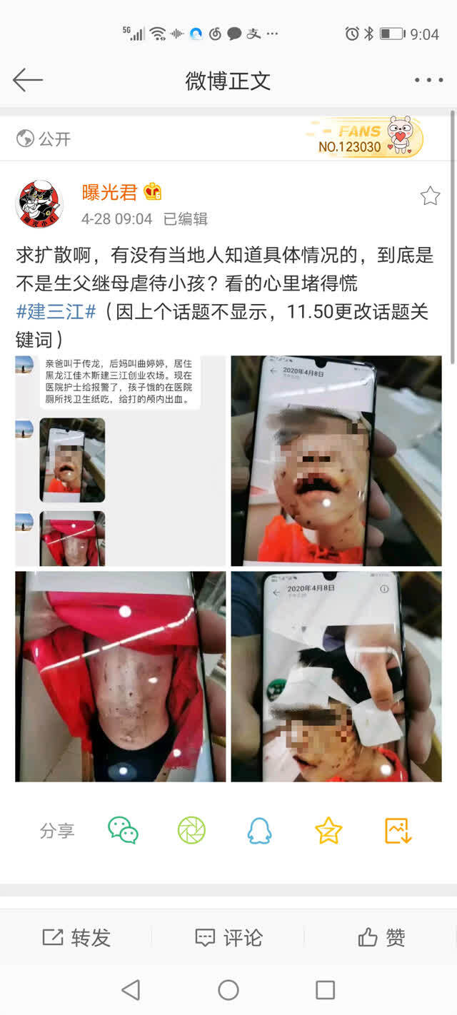 黑龙江4岁女童被虐打重伤进ICU始末：暴力是如何失控的