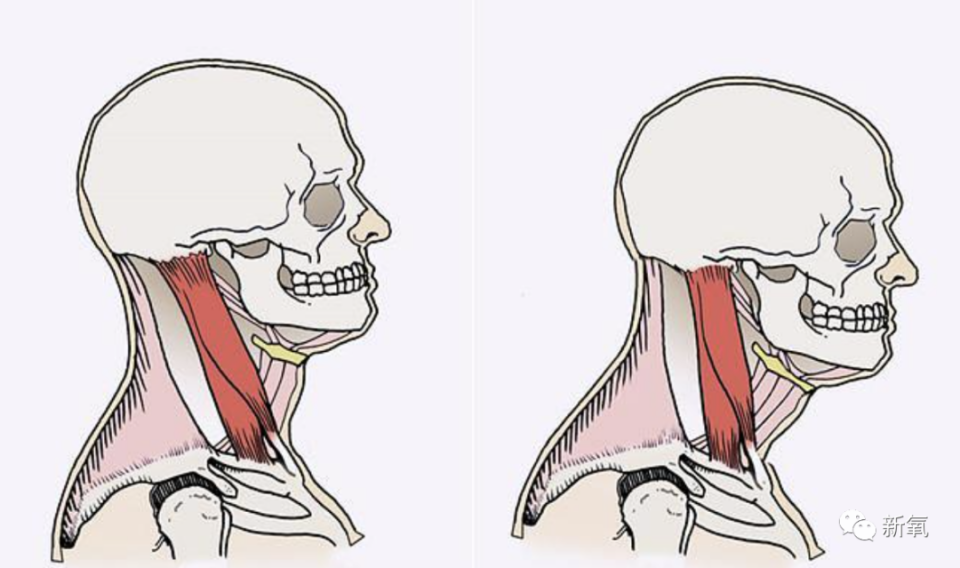 女人天下 正文 其实挺简单的,头前伸给我们的颈椎施加了机械压力,那
