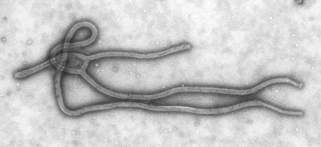 雷斯顿埃博拉病毒的电镜图片 图片来源:cdc/ cynthia goldsmith