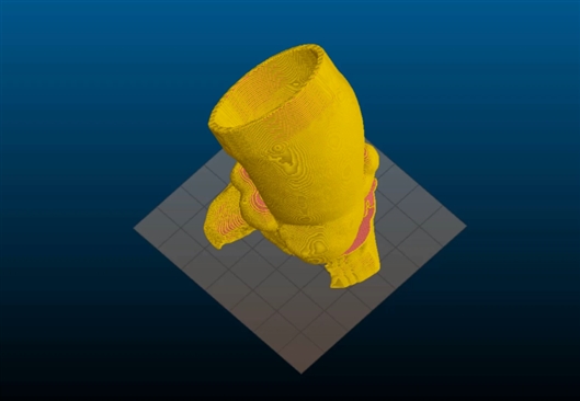 用多材料3d打印出心脏主动脉瓣及其周围结构的逼真模型,能模仿