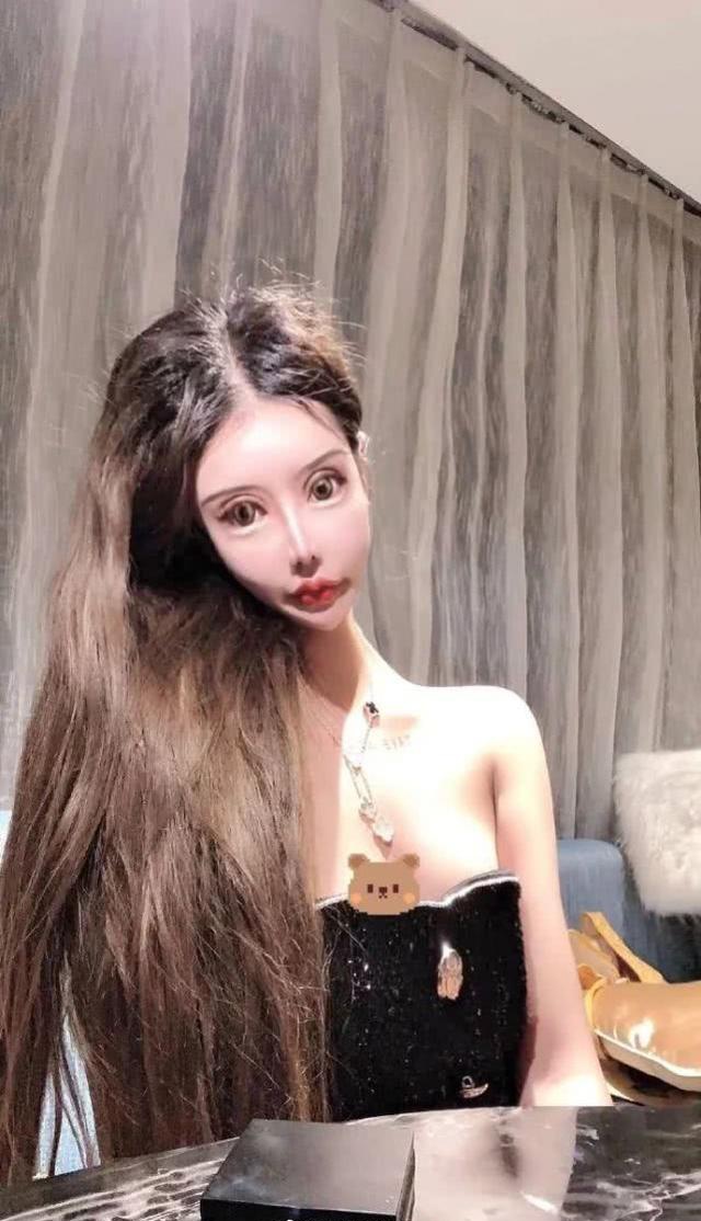 做6次双眼皮4次鼻子,下巴似铁锥眼睛整成球,16岁就整成这样好吗