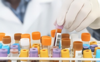 这国2019年初的血液样本中，竟检测到新冠病毒抗体