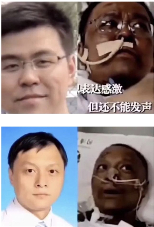 中国科学报：新冠肺炎重症患者皮肤为啥会变黑？