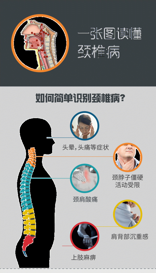 颈椎病知识全面图解析 凤凰网