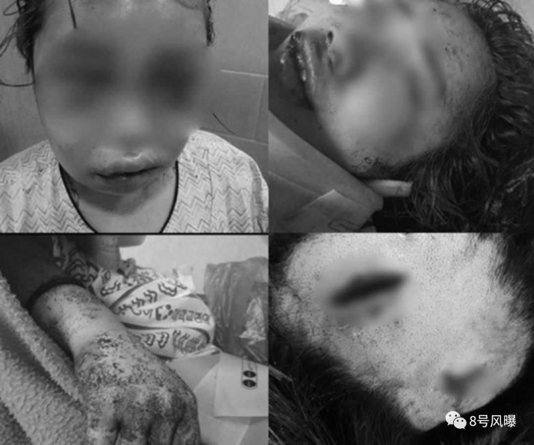 5岁被性骚扰,17岁遭男友扒光衣服暴打…韩国女孩成