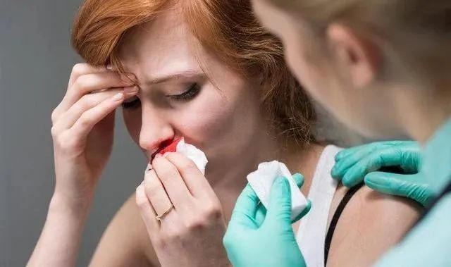 鼻出血事虽小背后或有大疾病,专家教你如何正确止血