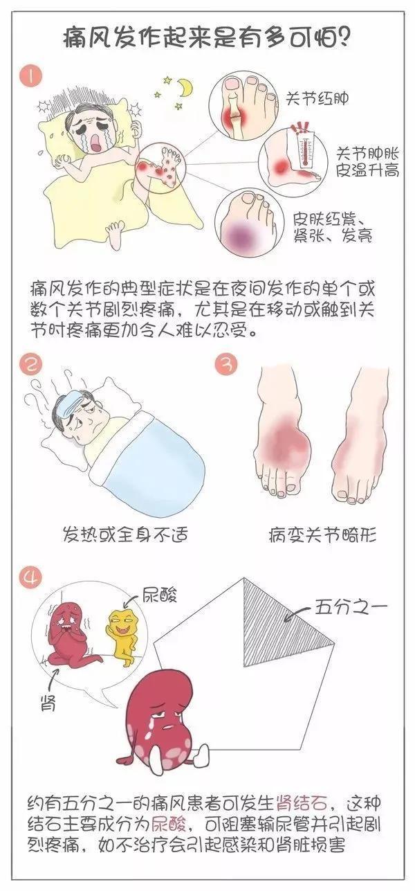 痛风是会呼吸的痛尿酸流在血液来回滚动