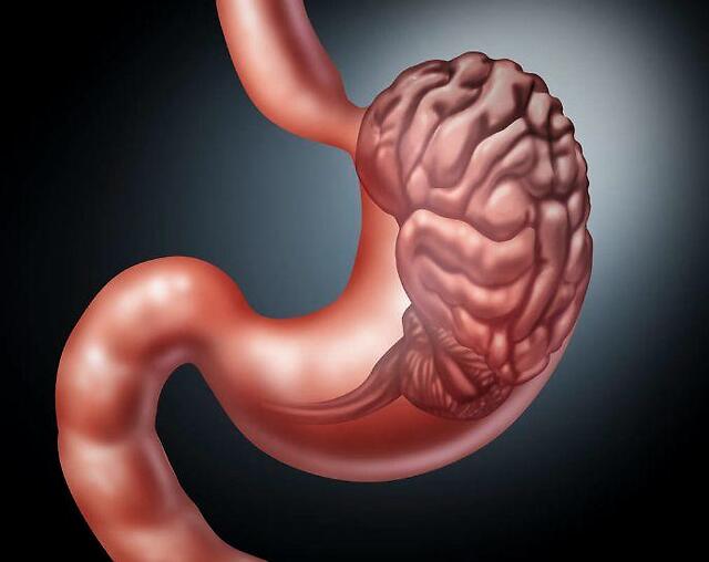 29岁女子查出胃癌晚期饭后出现3种异常最好查一下胃镜