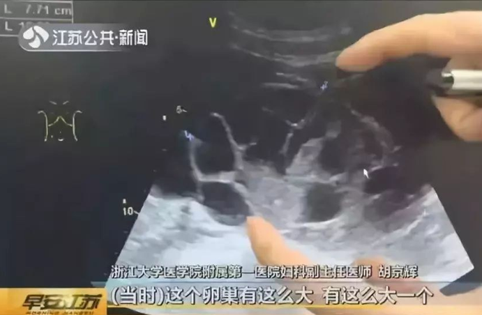 无知 为买新款苹果手机 20岁女孩地下诊所卖卵 报酬仅1万 凤凰网健康 凤凰网