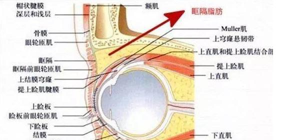 muller肌眼睑图片