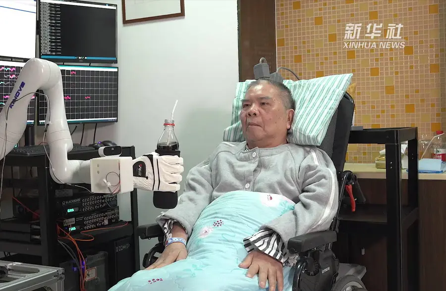 浙江一瘫痪患者用“意念控制”重获运动能力