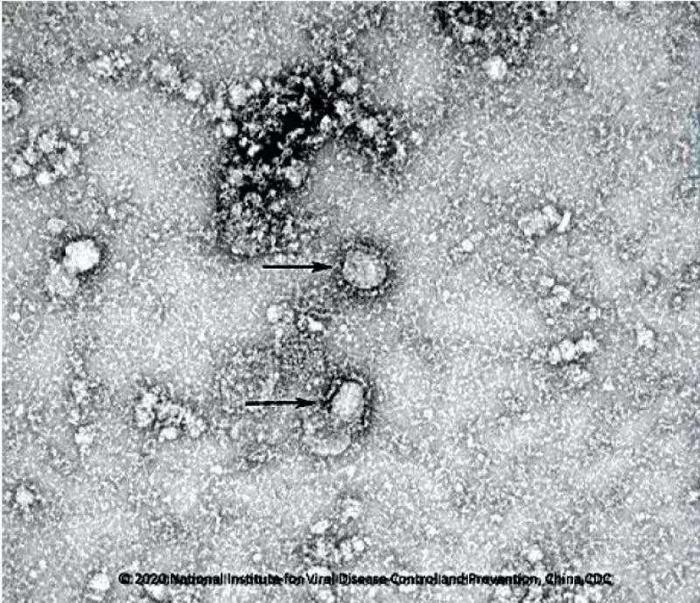 照片来了！新型冠状病毒毒种信息及其电镜照片公布